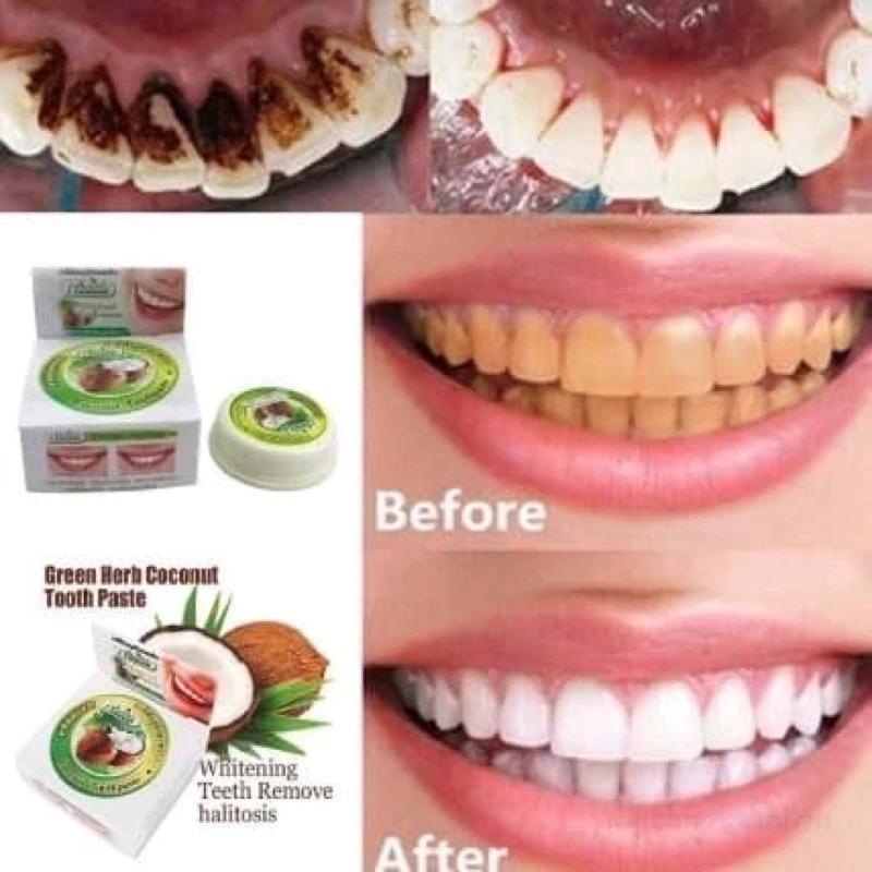 Kem Tẩy Trắng Răng Loại Bỏ Ố Vàng Làm Trắng Răng Green Herbal Novolife Thái Lan